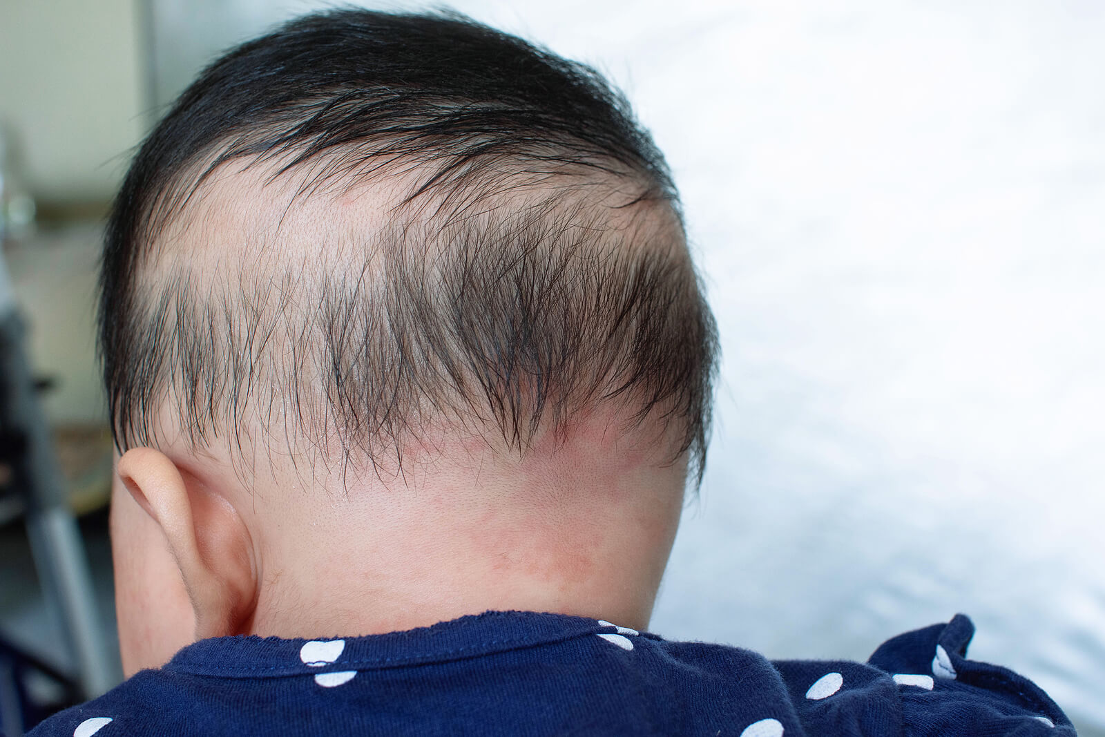Pourquoi Les Cheveux Des Enfants Tombent ils pourquoi-les-cheveux-des-enfants-tombent-ils