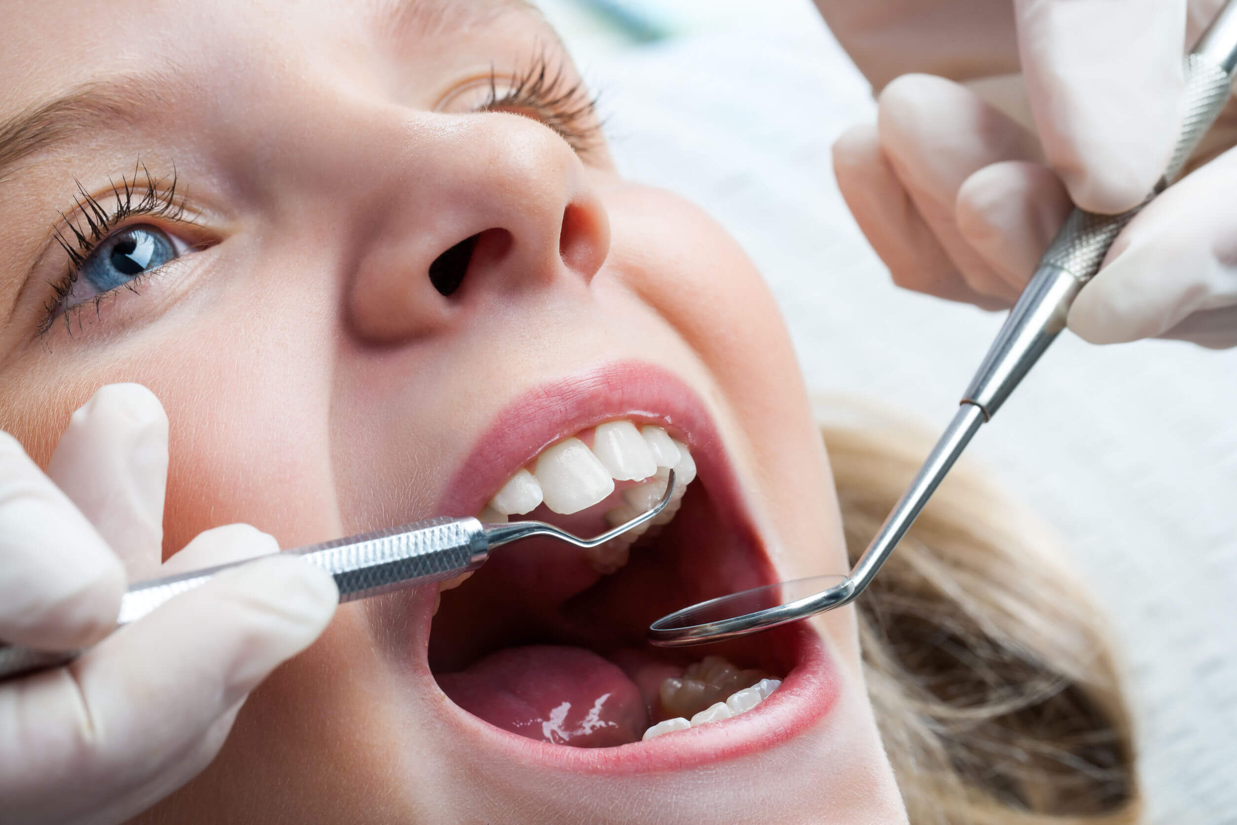 Niña haciéndose una limpieza dental en el dentista.