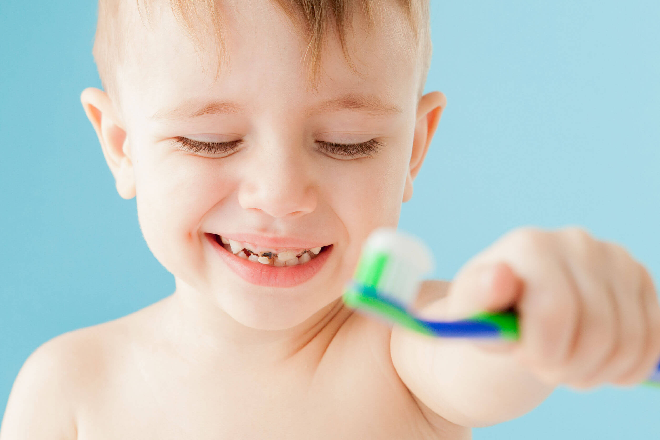 Mi hijo tiene un diente negro: ¿por qué y qué puedo hacer?