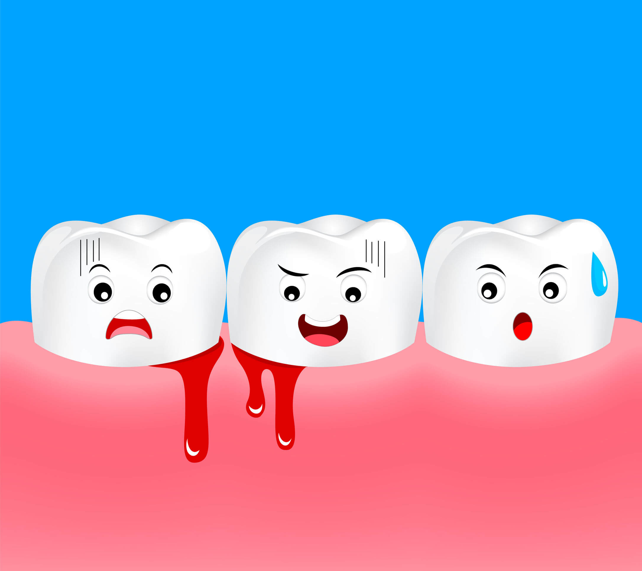La gingivite chez les enfants n'est pas aussi fréquente que chez les adultes, mais il est nécessaire de la prévenir avec de bonnes habitudes d'hygiène bucco-dentaire.
