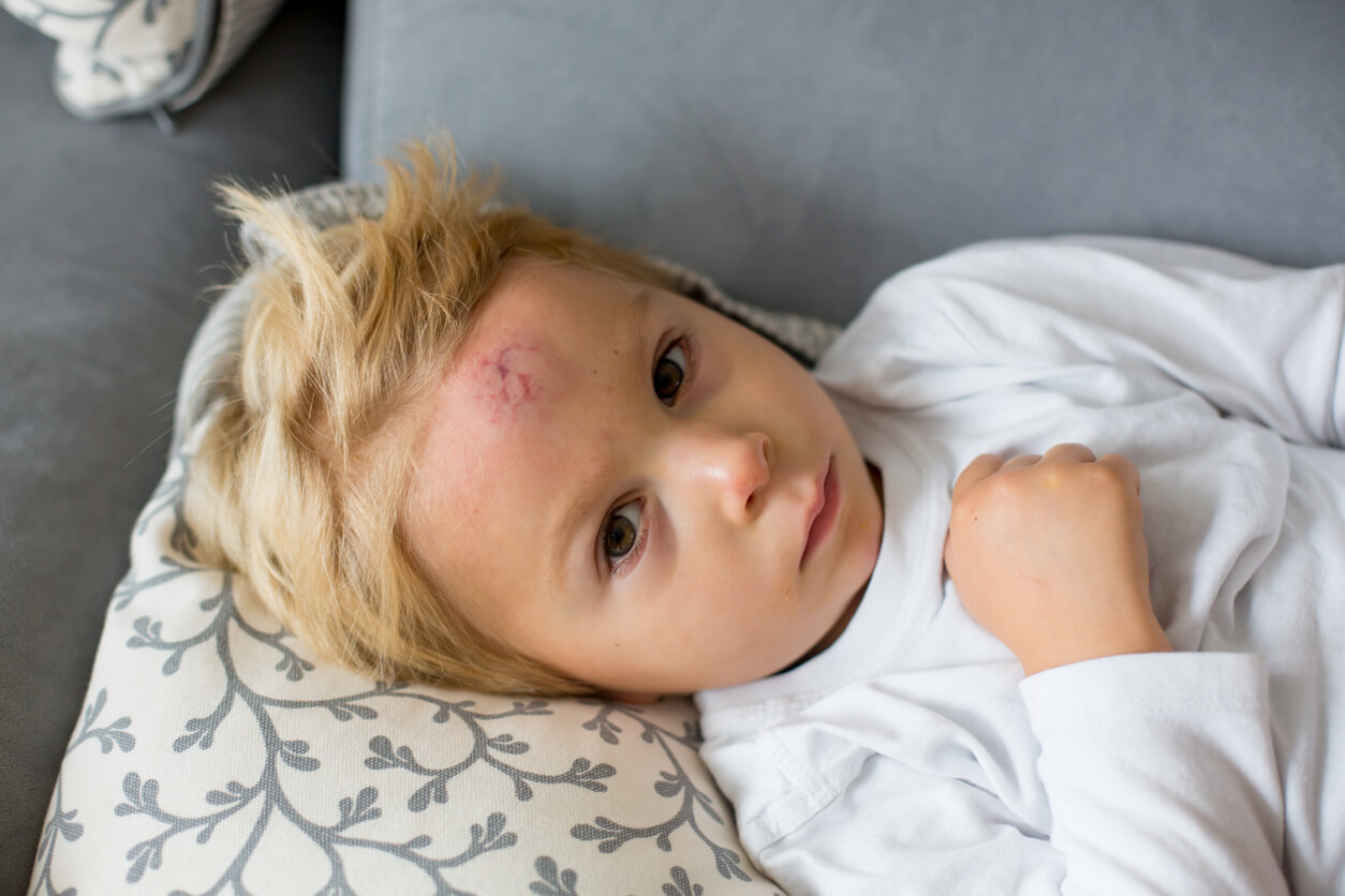 10 trucos para curar chichones en los niños