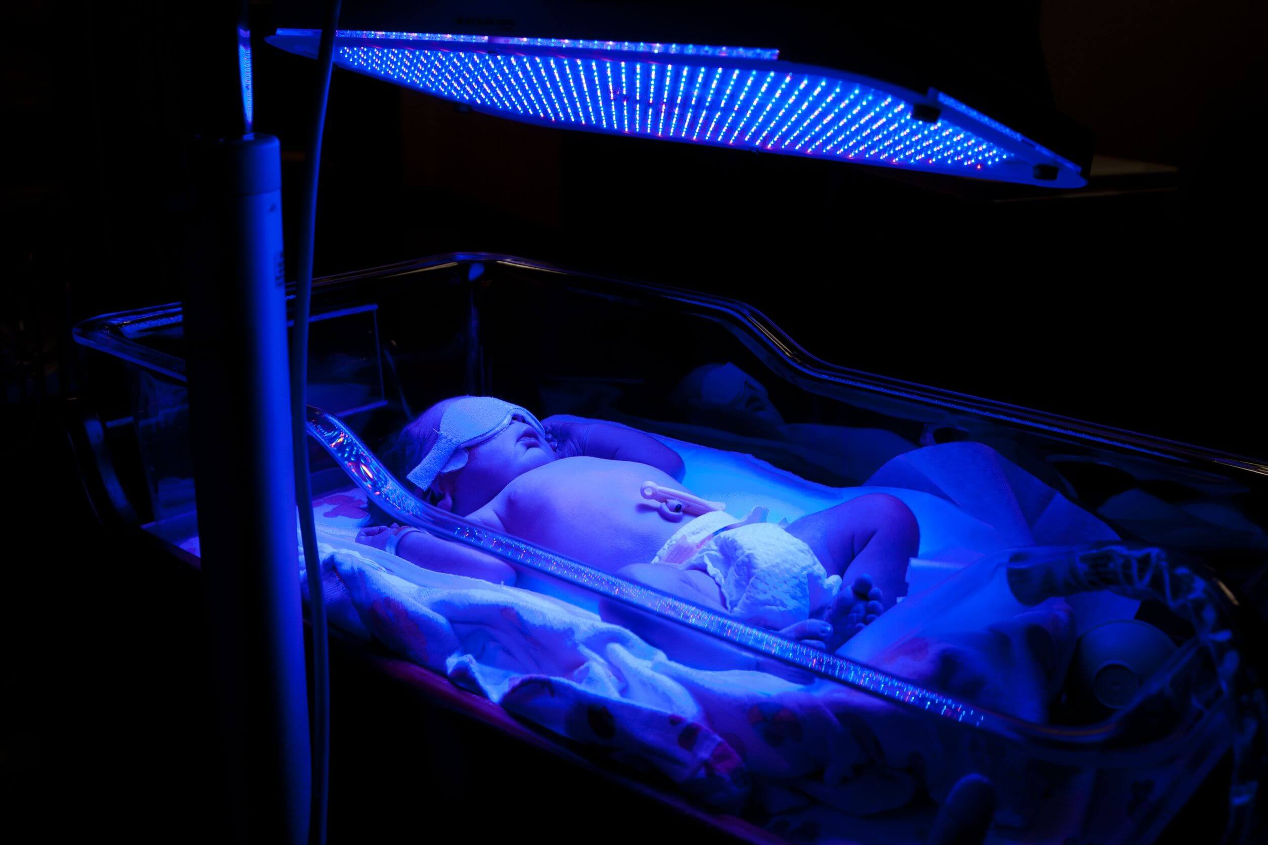 En nyfødt baby under et blått lys.