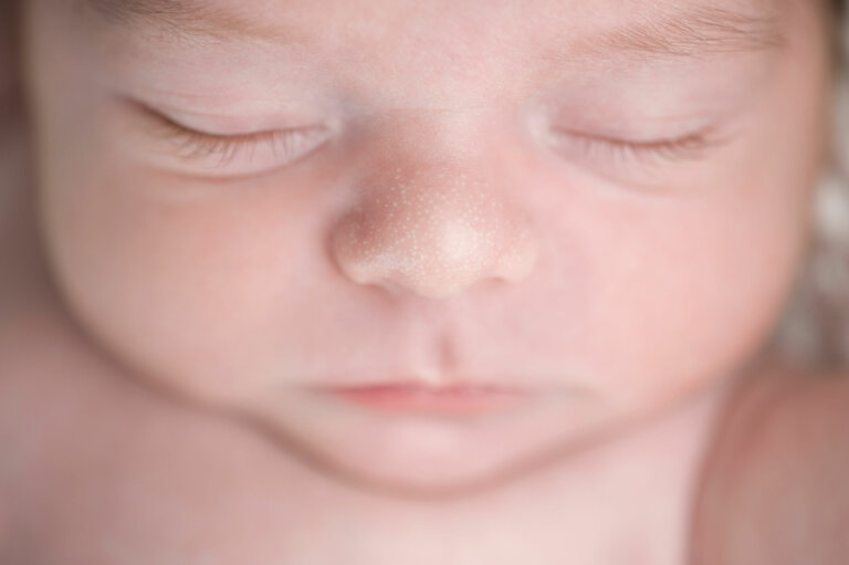 Miliums o miliaria en bebés: ¿en qué consiste?