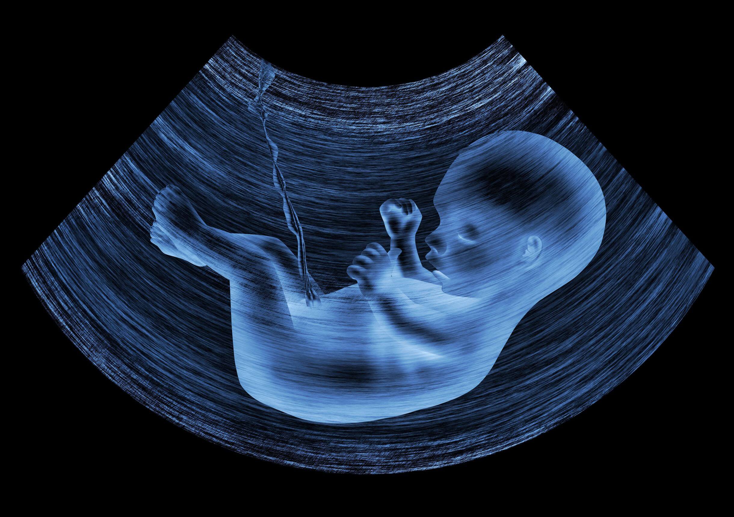 Echographie d'un foetus.
