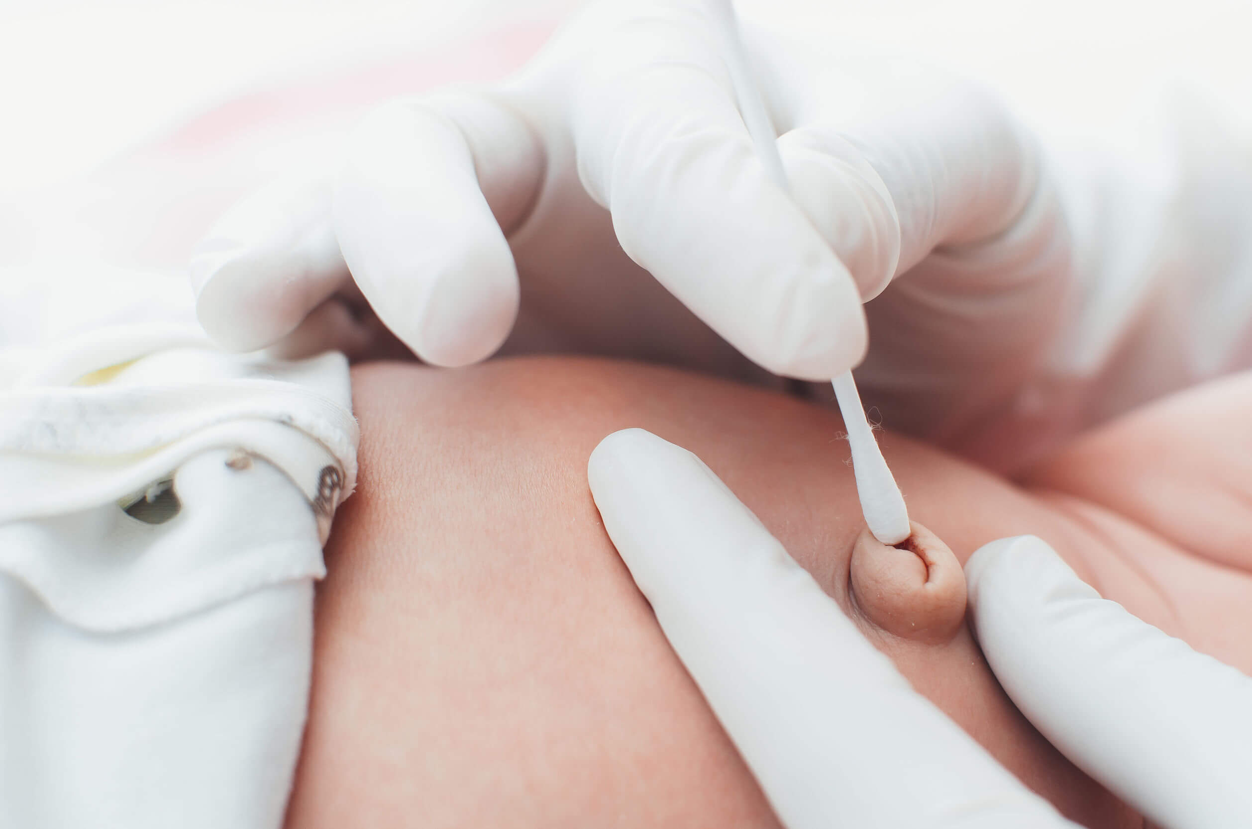 Det är möjligt att förhindra infekterade navelsträngar.