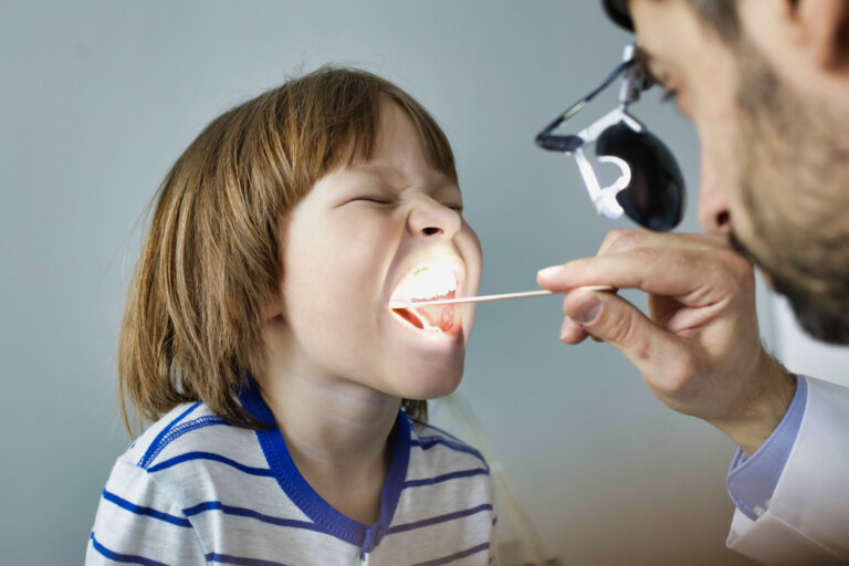 Tonsilolitos en niños: síntomas y tratamientos
