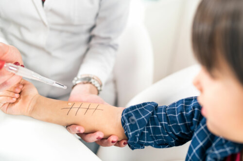 Cómo son las pruebas para la detección de alergias en niños