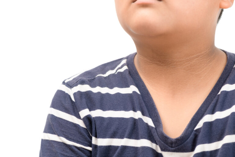 Acantosis pigmentaria en niños: características, causas y tratamiento