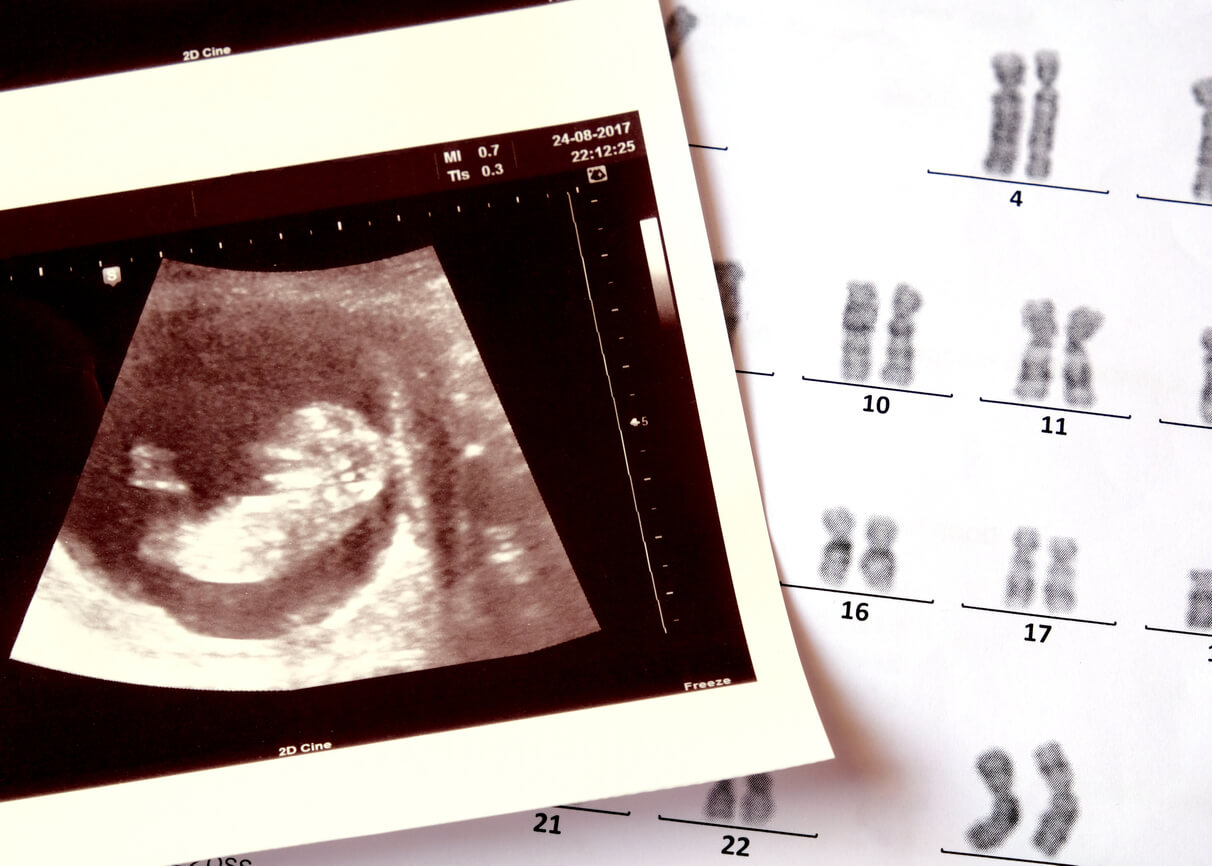 The results of prenatal genetic testing.