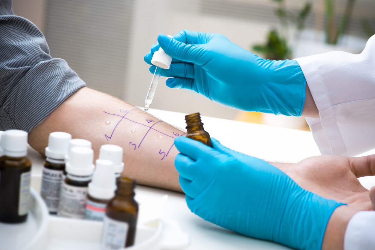 test d'allergie cutanée allergologue de la peau gant d'avant-bras compte-gouttes en latex allergène allergène