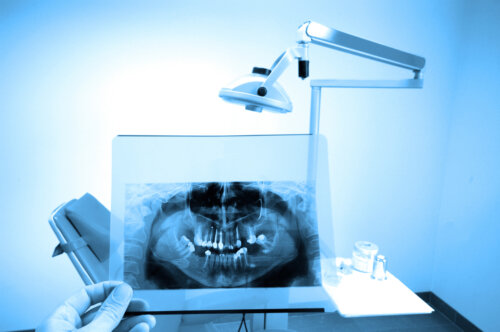 radiografia dental odontologica sillon dentista