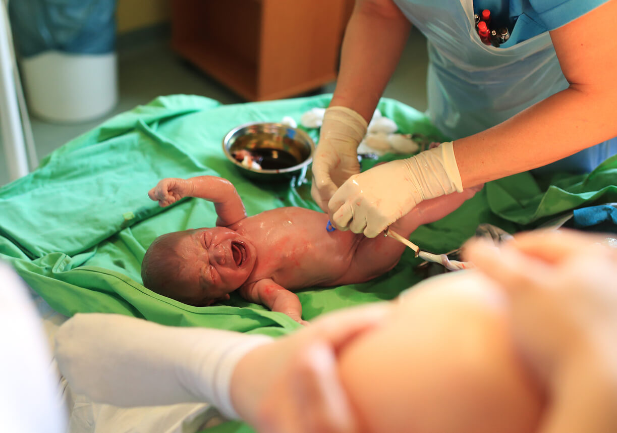 neonato sala parto nacimiento mesa recepcion cuidado recien nacido cordon umbilical clampeo procedimiento neonatologo enfermera cuidados bebe llora