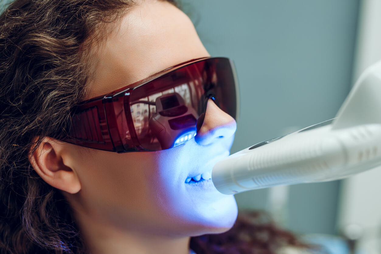 A teen girl undergoing a tooth whitening process.