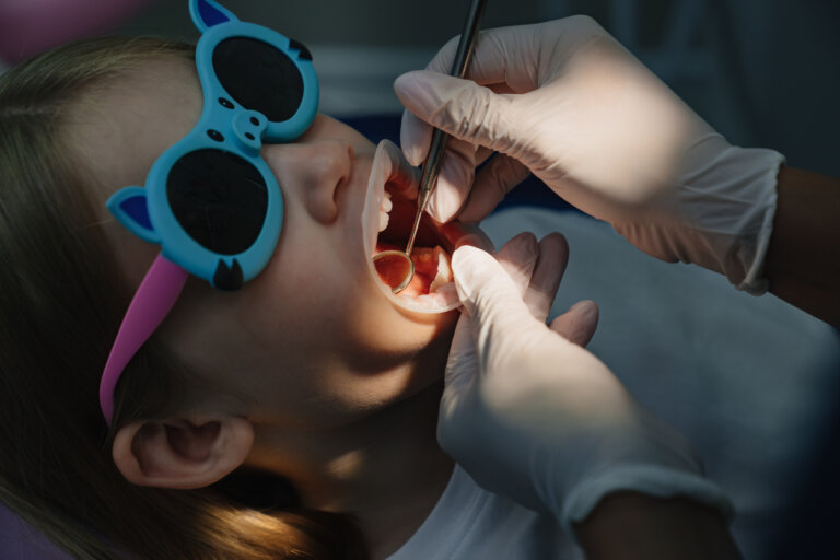 Blanqueamiento dental en niños: ¿es posible?