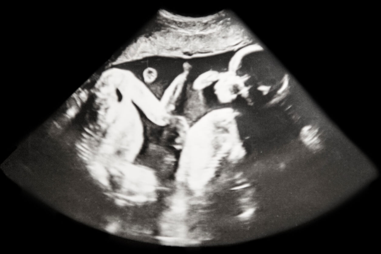 ecografia abdominal embarazo scan fetal gemelos dos bebes