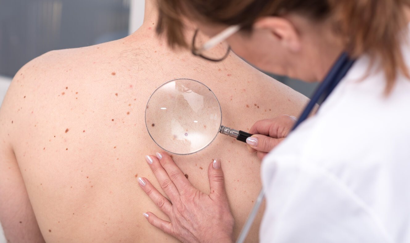 Examen des taches de rousseur et grains de beauté.