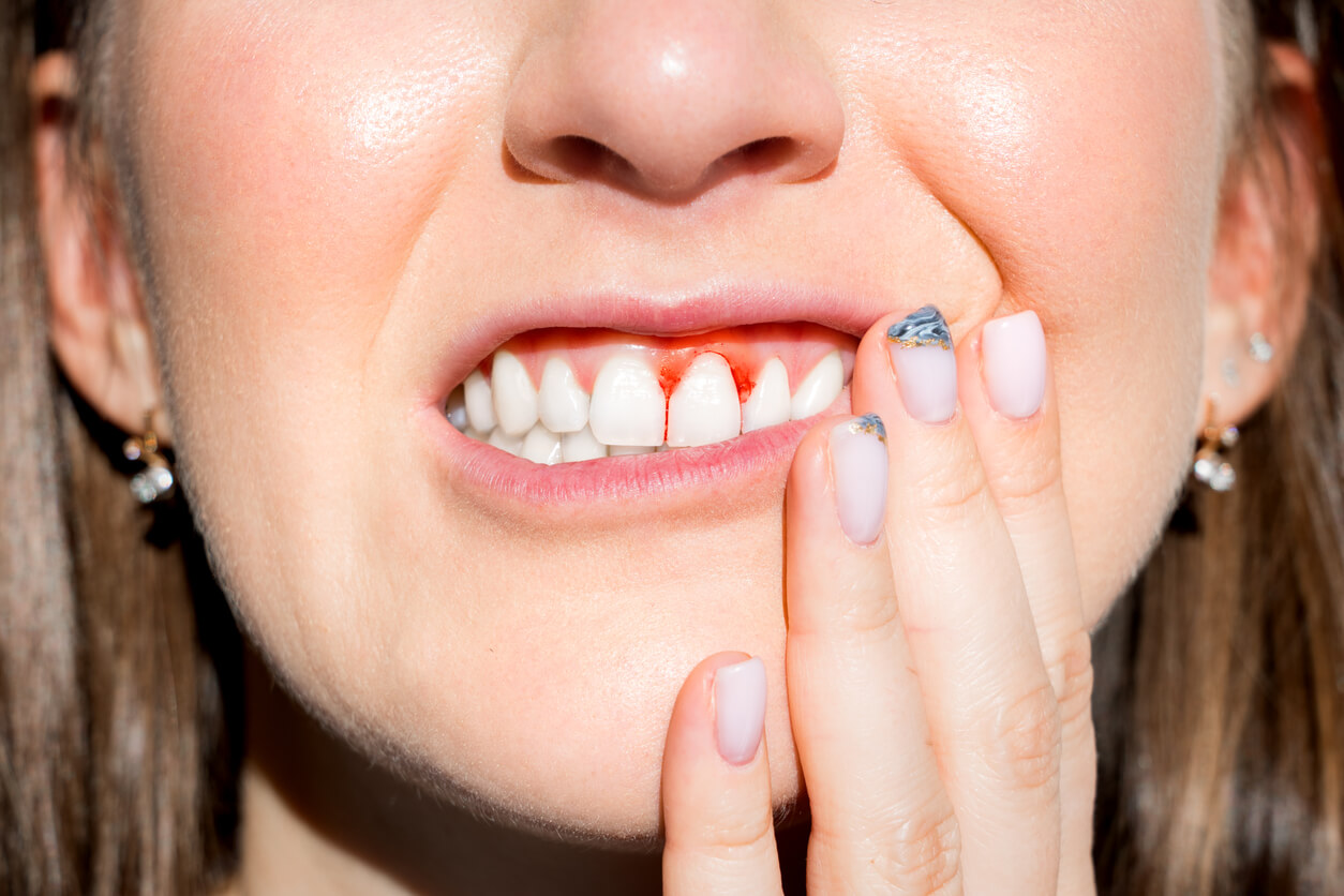gingivitis inflammation pain gums periodontitis mouth disease oral health prevention treatment infertility