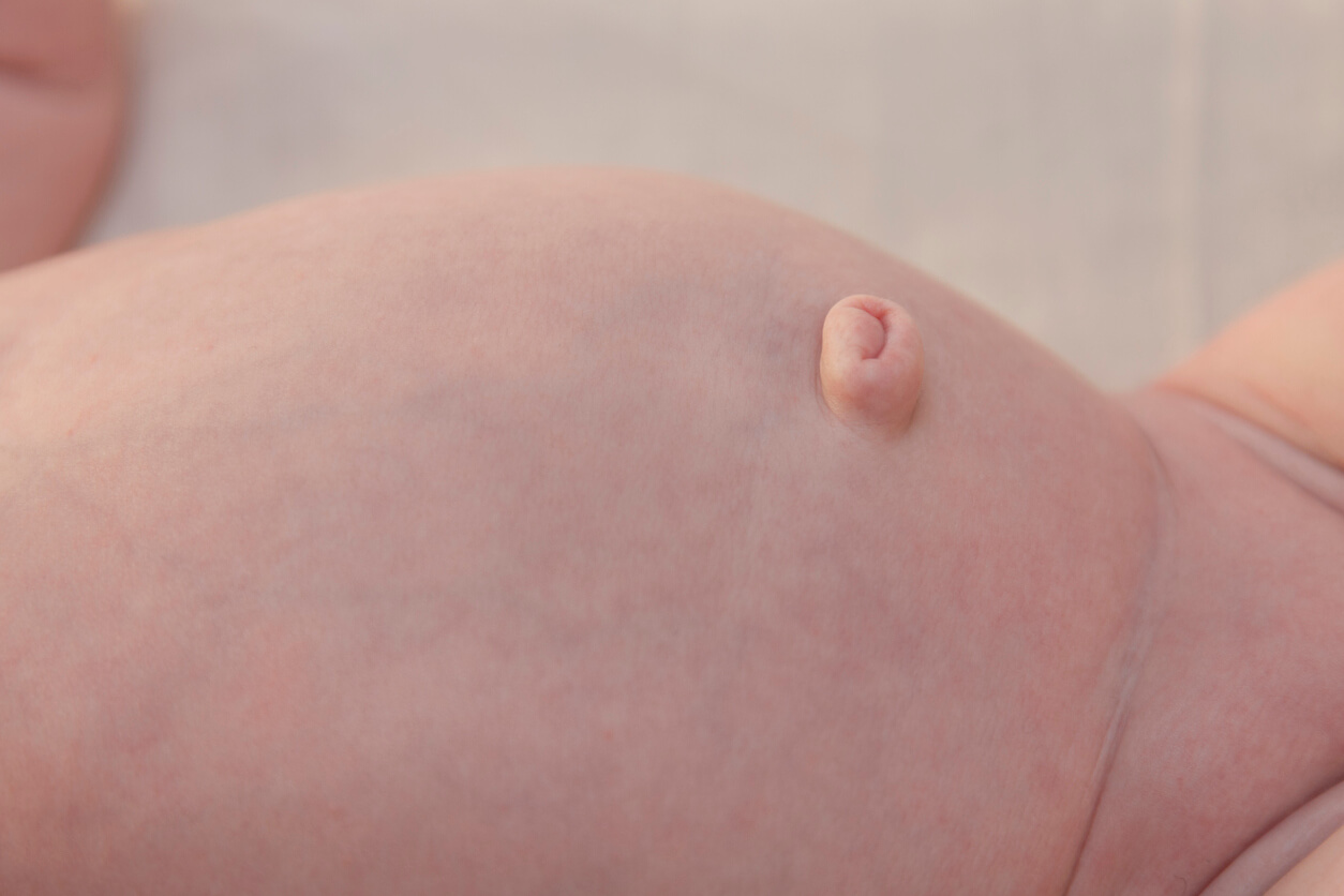 bebe lactante recien nacido neonato abdomen distendido distension abdominal