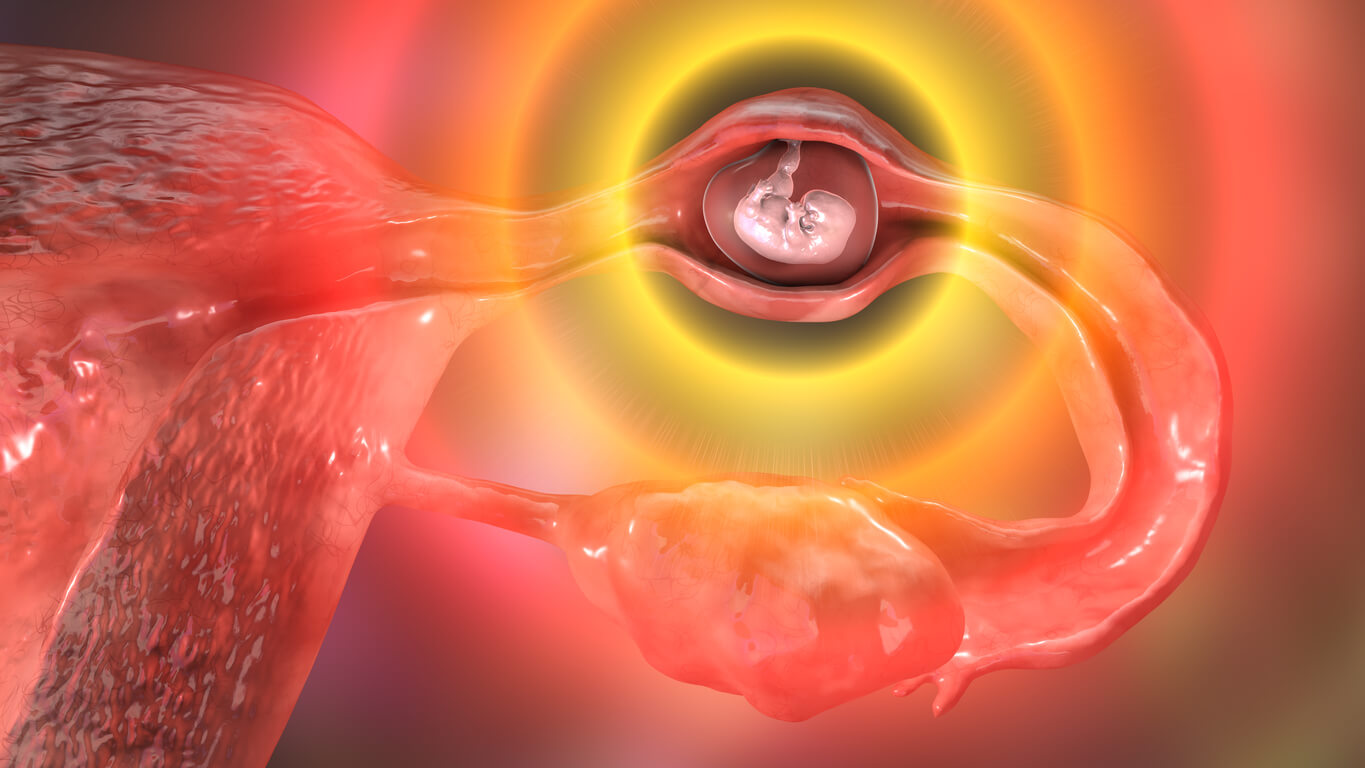 grossesse extra-utérine.