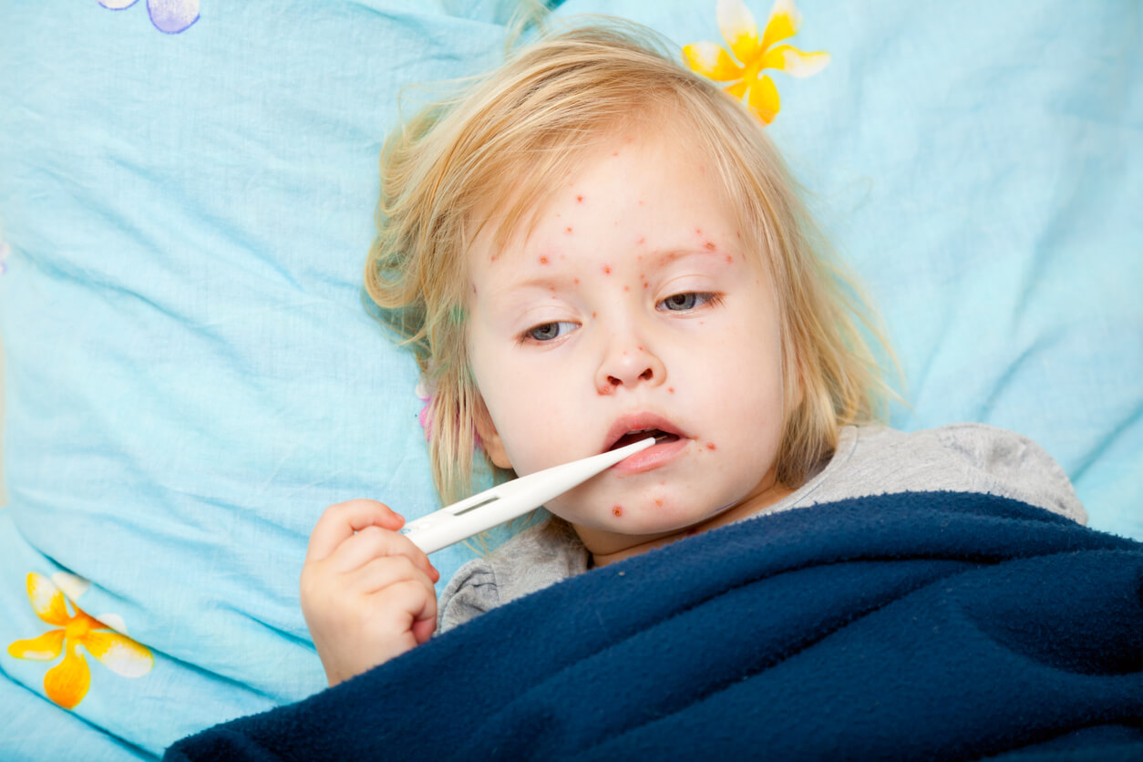 Une jeune fille malade avec des boutons rouges sur le visage.