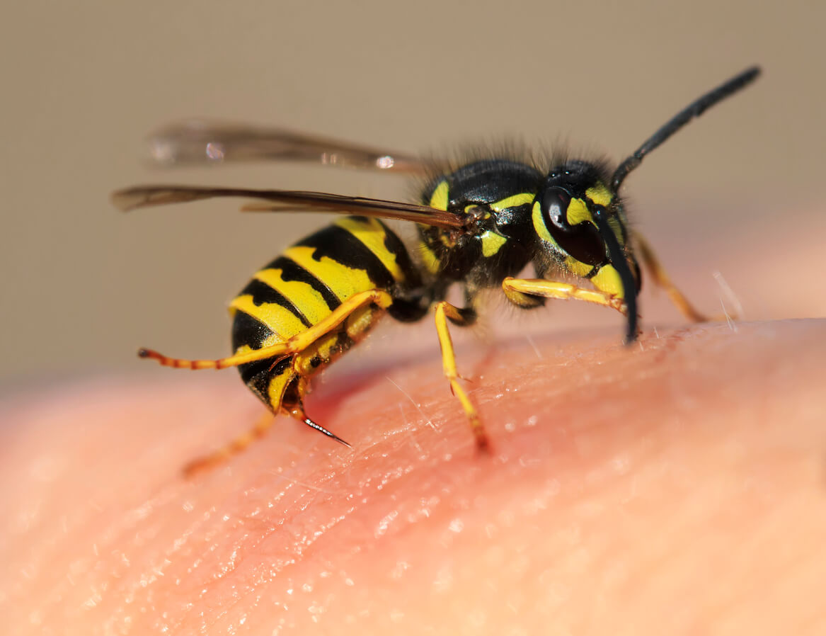 Uma vespa picando pele.