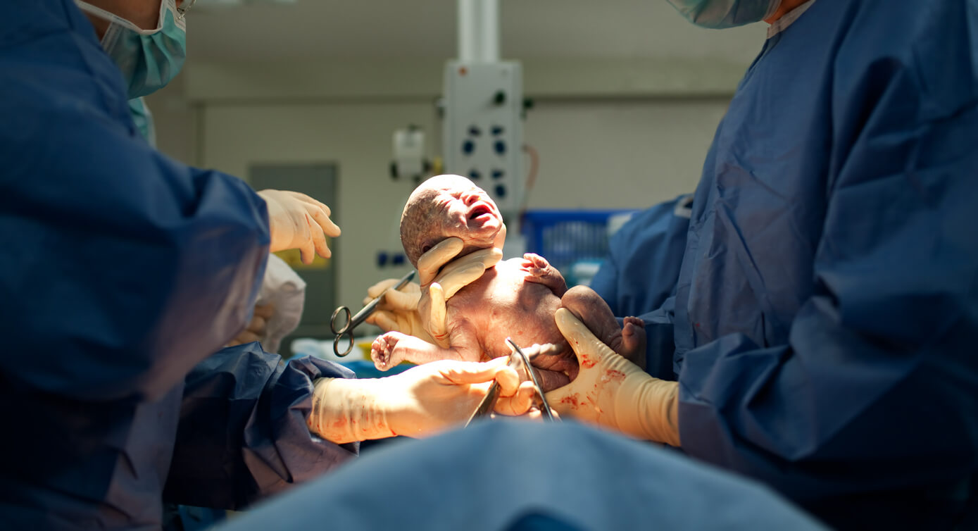 naissance bébé en salle d'opération obstétricien césarienne