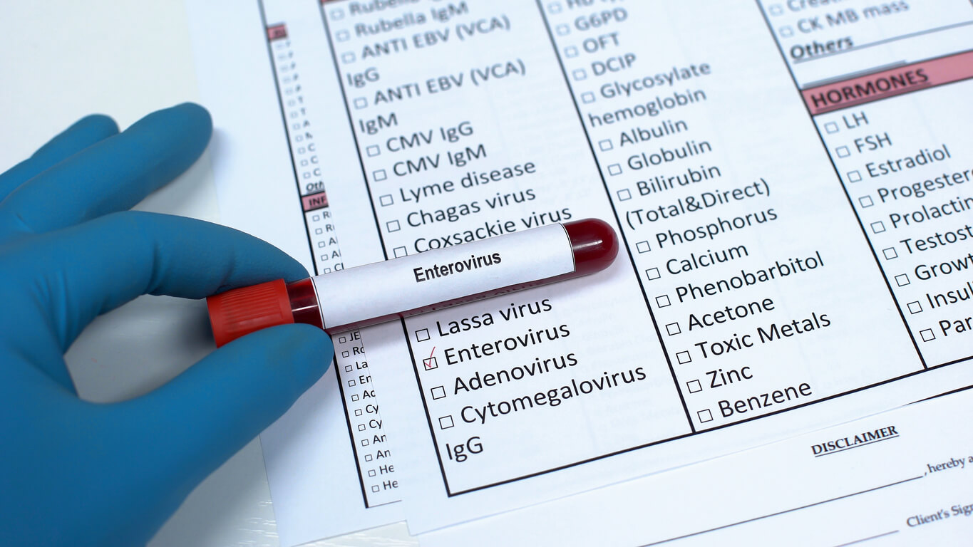 mano bioquimico guante tubo sangre serologias lista enterovirus diagnostico microbiologico
