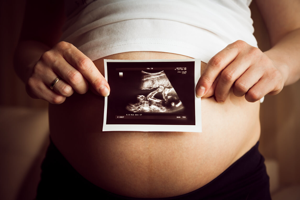 A pregnant woman holds an ultrasound photo of her baby.