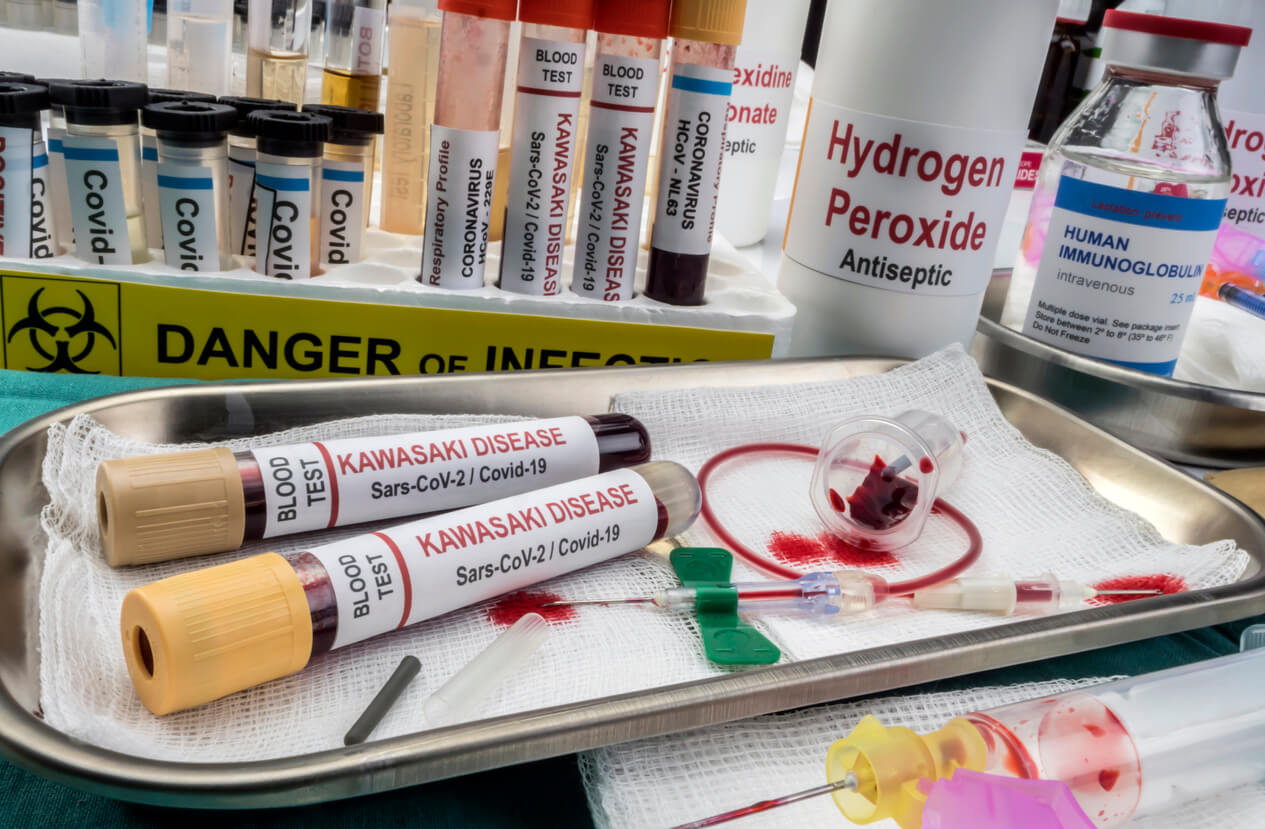 échantillon de sang laboratoire.