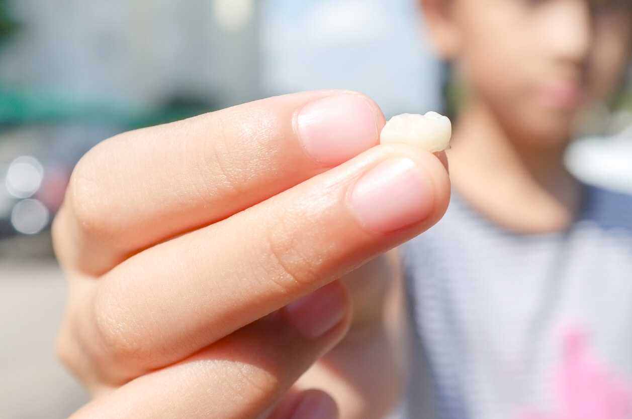 ¿Se puede reimplantar un diente de leche?