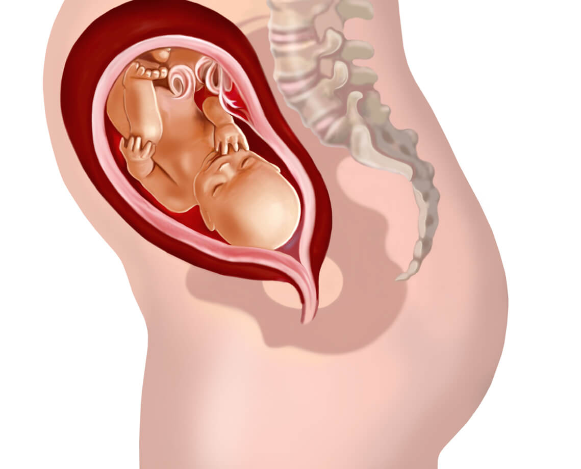 Schéma d'un bébé qui se présente par la tête dans le canal de naissance.
