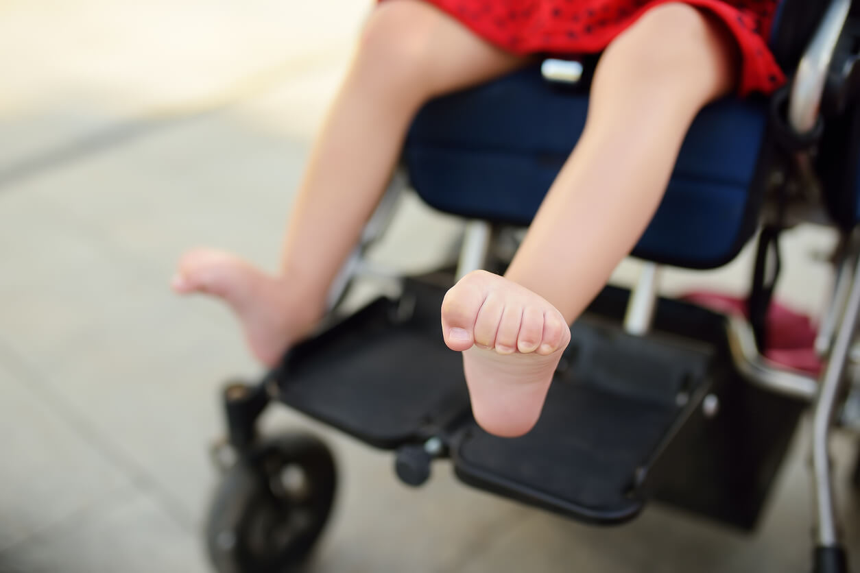 piedi bambino rigidità alla flessione plantare