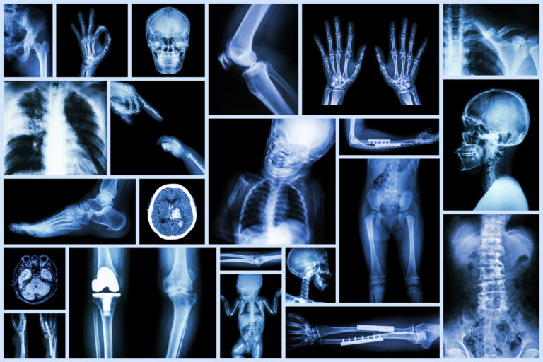 Radiografías en niños: lo que debes saber