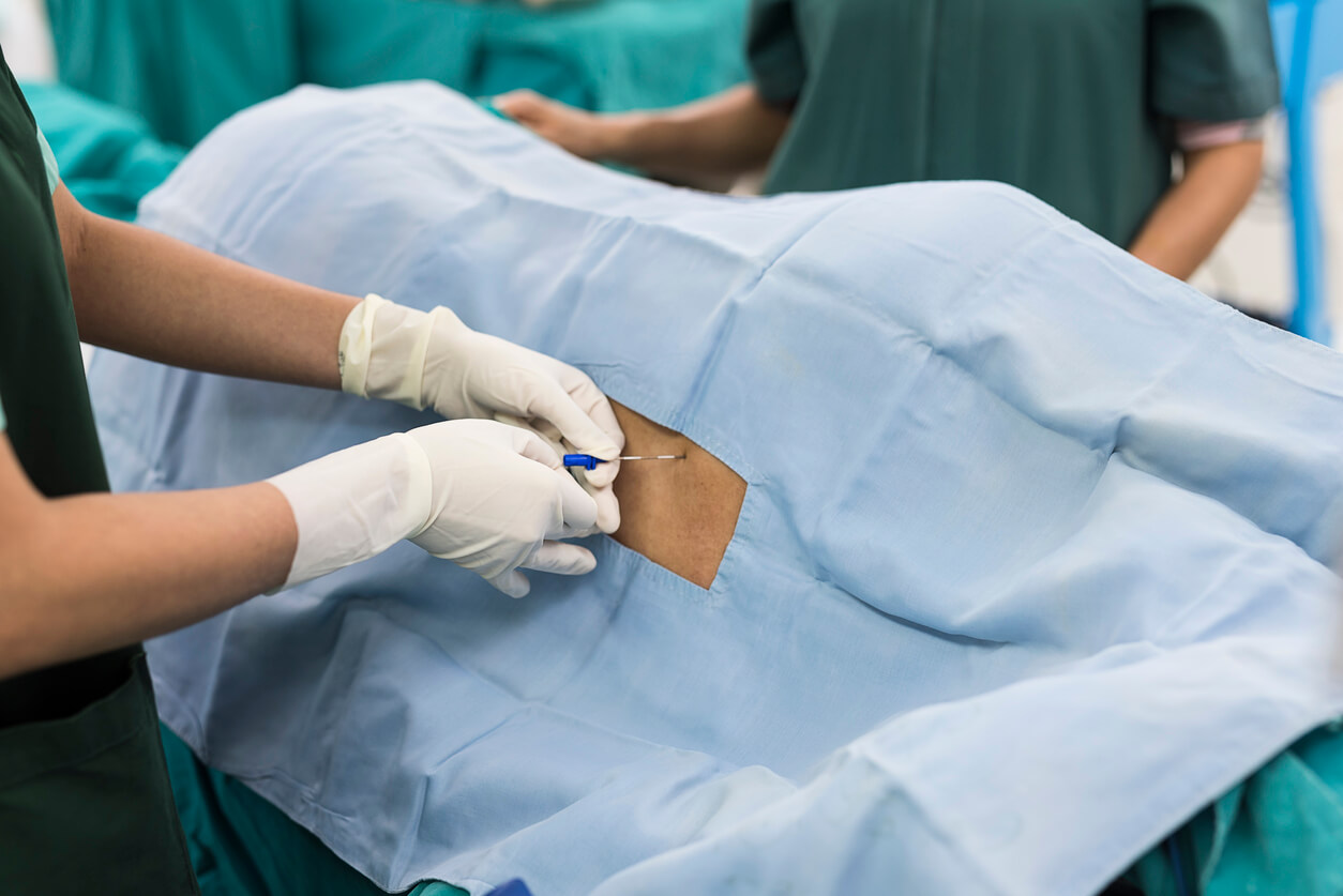 l'anestesista pone l'operazione di anestesia in sala operatoria con catetere epidurale