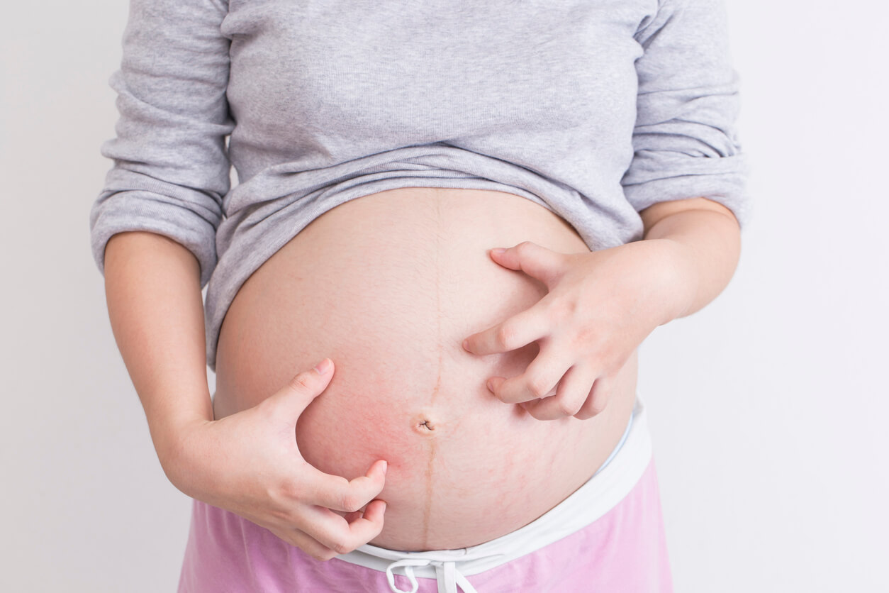 madre gestante embarazada padece picazon en el vientre prurito piel