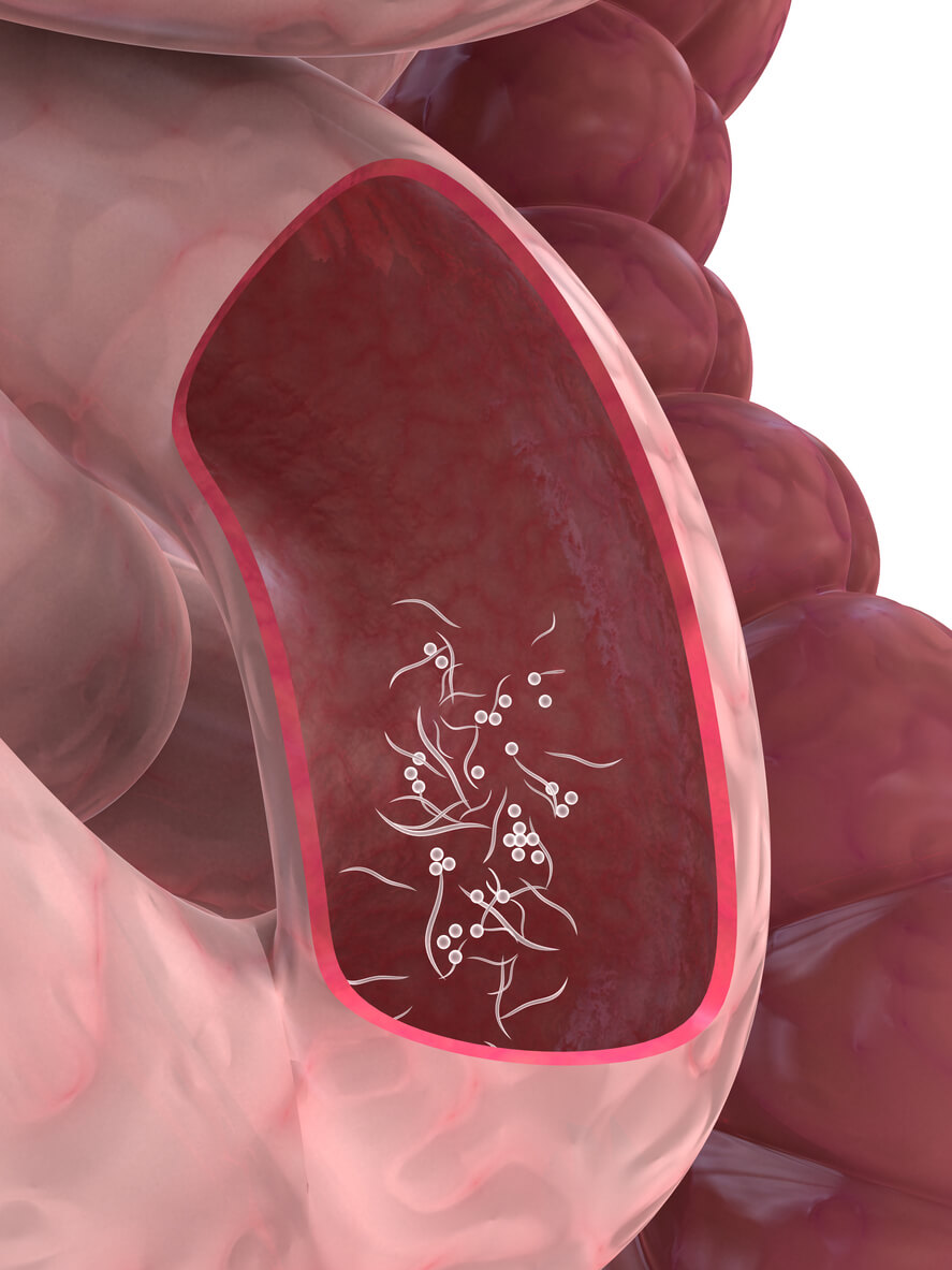 intestino delgado enterobius vermiculaaris larva madura pinworm oxiuros