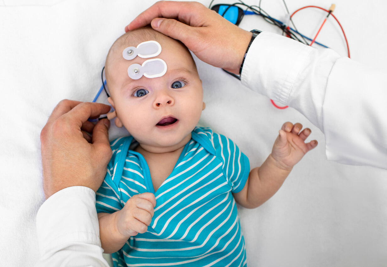 otoemisiones acusticas emisiones otoacusticas potenciales evocados auditivos bebe medico