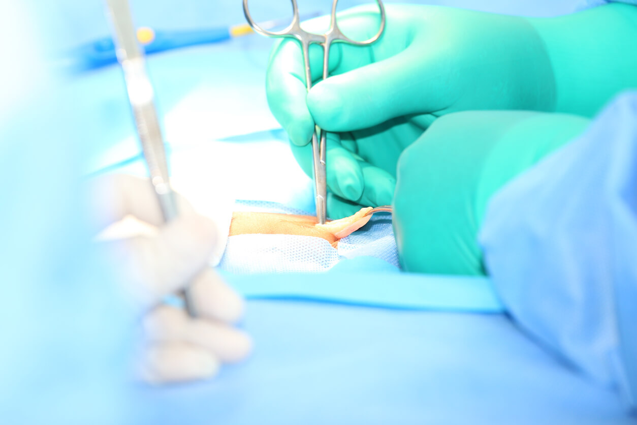 mains de chirurgien opérant une hernie abdominale