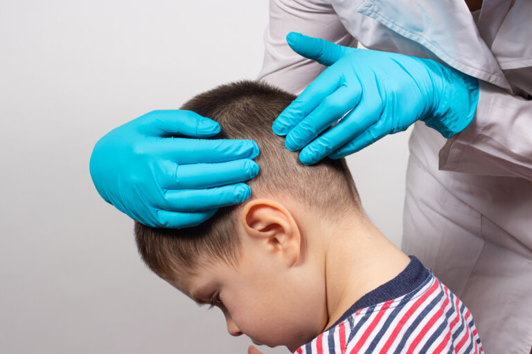 Los 10 problemas del cuero cabelludo más comunes en los niños