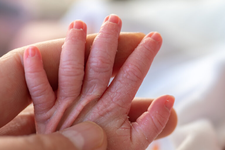 10 recomendaciones para cuidar la piel de los bebés prematuros
