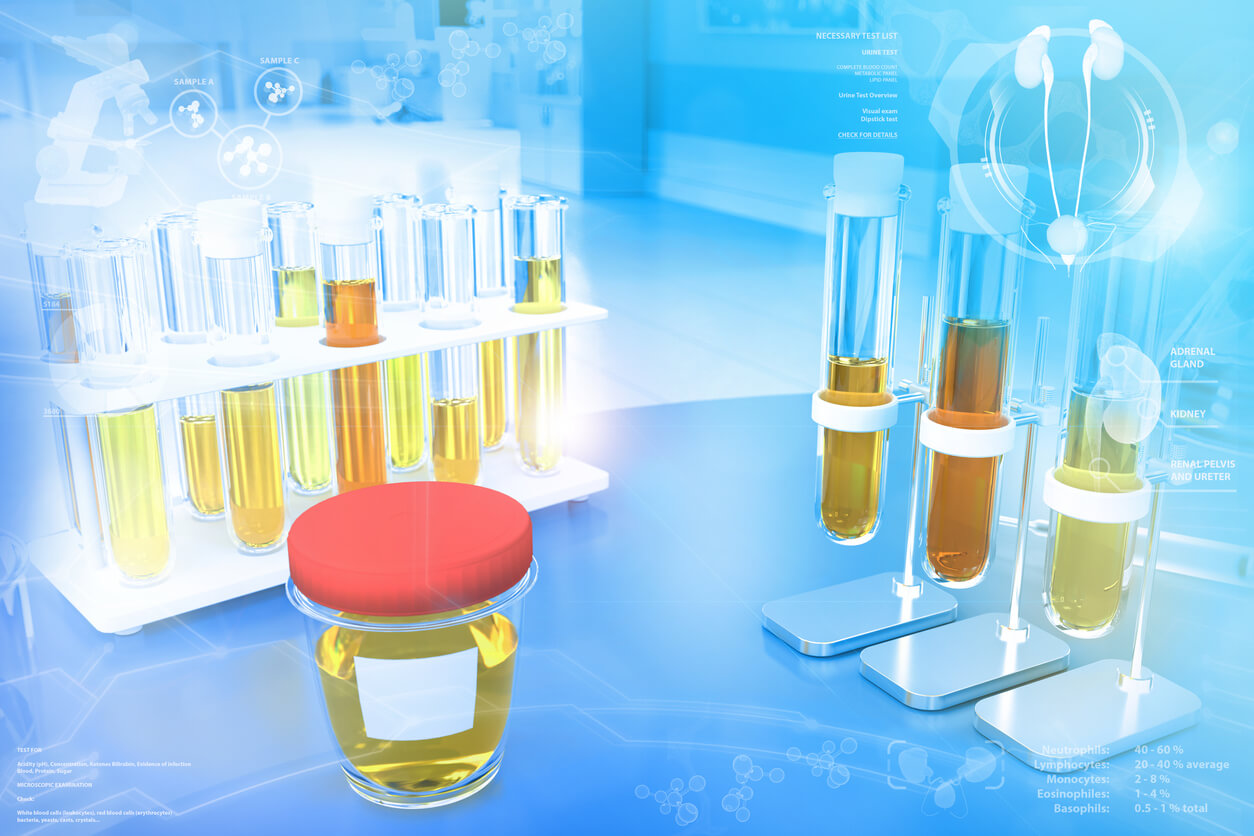 bouteilles d'urine pour examen biochimique chimie analyse d'urine laboratoire couleurs concentration