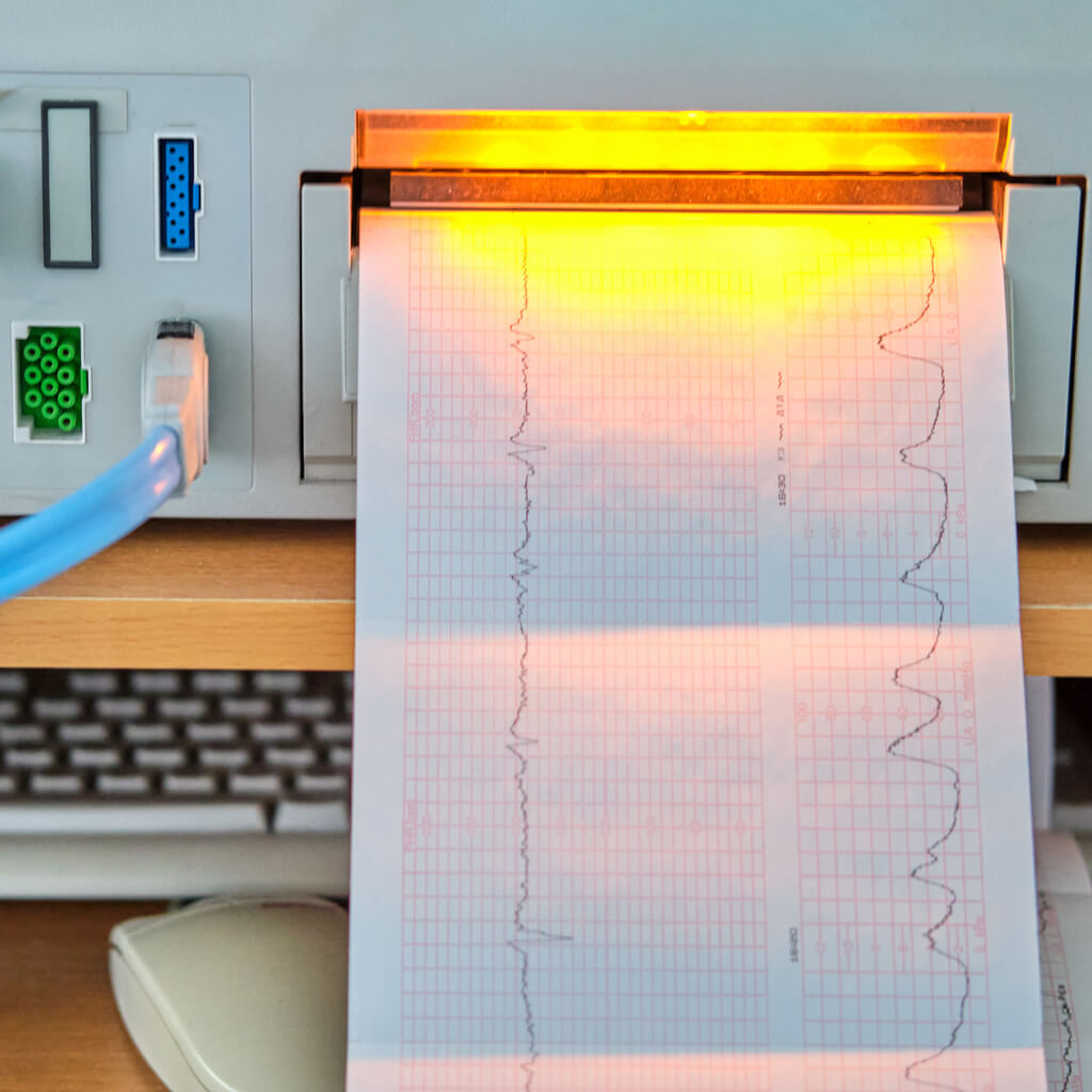 registro actividad fetakl cardiotocografia en papel monitor fetal computadora