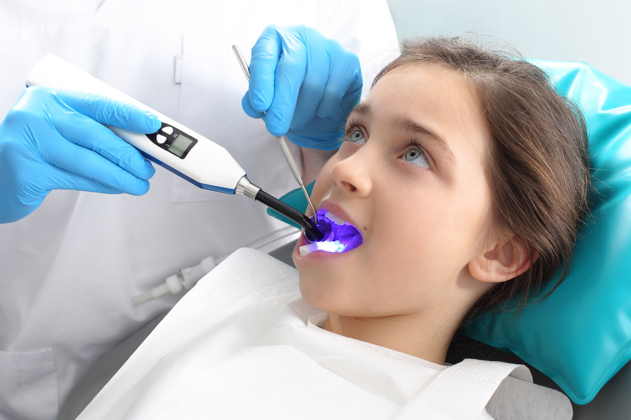 dentista coloca luz azul de secado en la boca nina sellador dientes