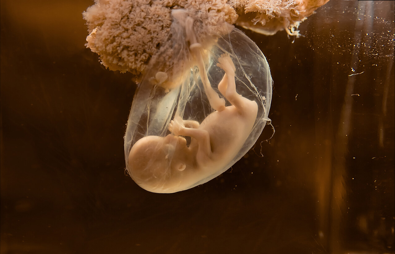 A fetus in the amniotic sac.