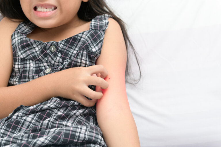 Dermatilomanía en niños: ¿en qué consiste?