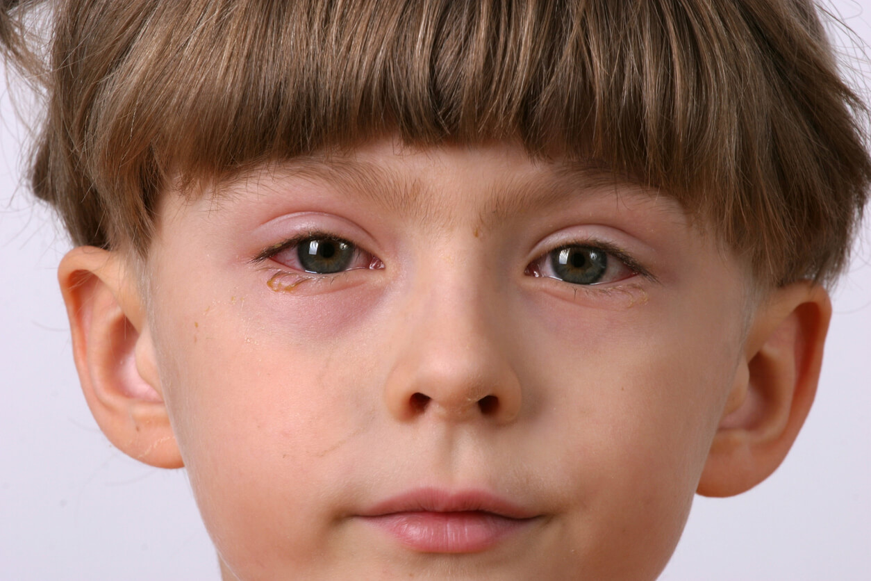 Et barn med rosa øyne.