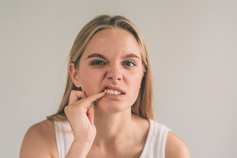 Cómo prevenir la gingivitis en la adolescencia