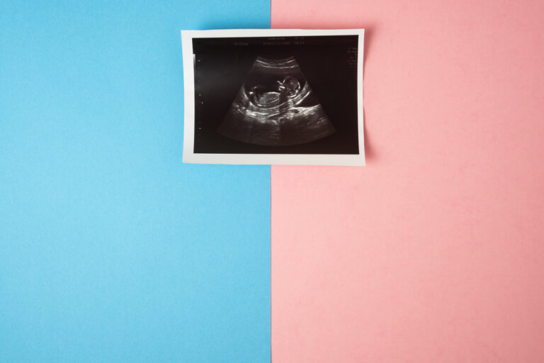 Conocer el sexo del bebé en la primera ecografía: ¿es posible?