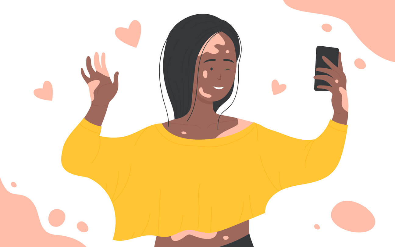 A digital drawing of a girl with vitiligo smiling and taking a selfie.