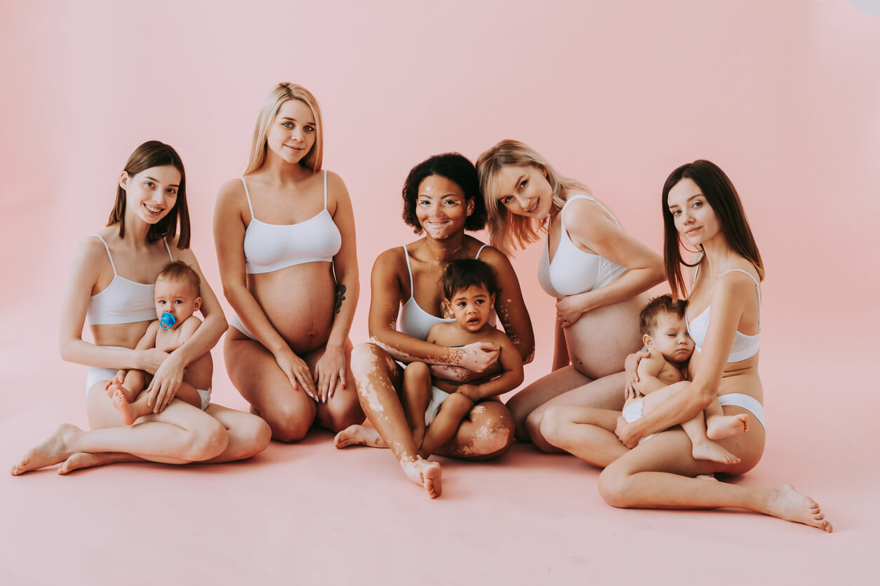 En gruppe mødre, hvorav en har vitililgo, med babyene sine.